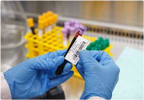 Aplicación en un tubo con sangre